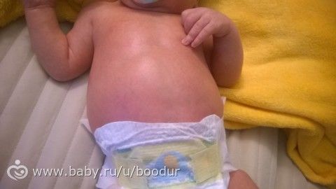 Новорожденный не днем из-за животика Новорожденный не днем из-за животика