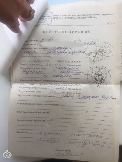 Умеренная дилатация боковых желудочков головного мозга.