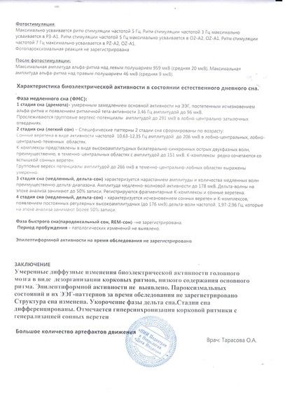 Помогите расшифровать ЭЭГ!