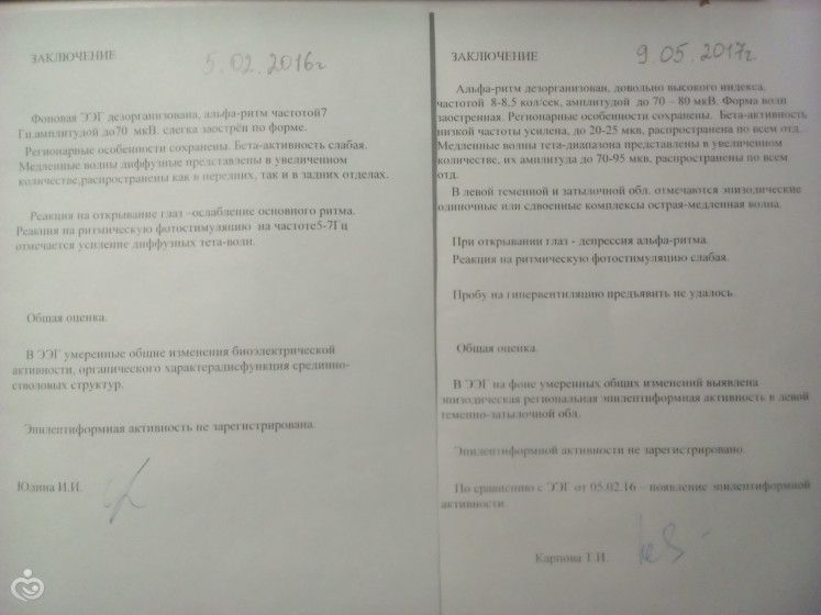 Результат ЭЭГ, незнаю что делать что думать....
