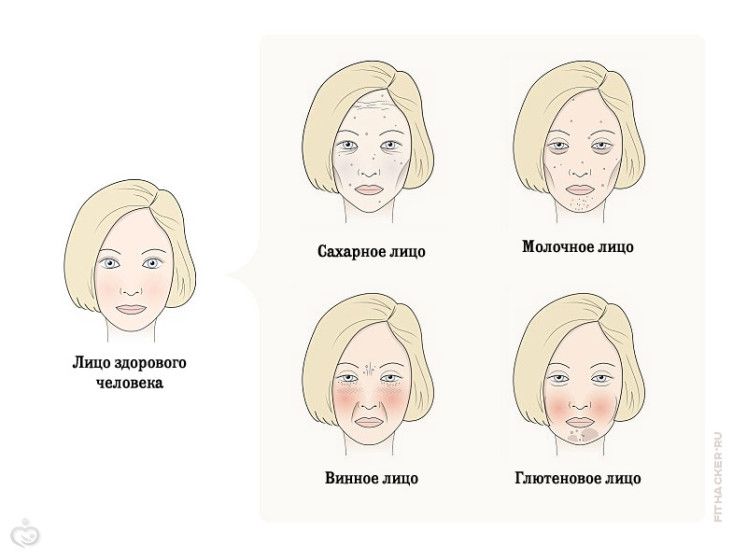 4 продукта, которые портят ваше лицо