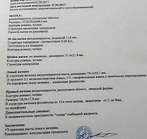 Киста
